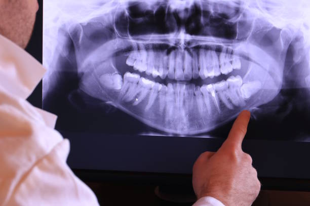 Best Weekend Emergency Dentist in Tillson, NY